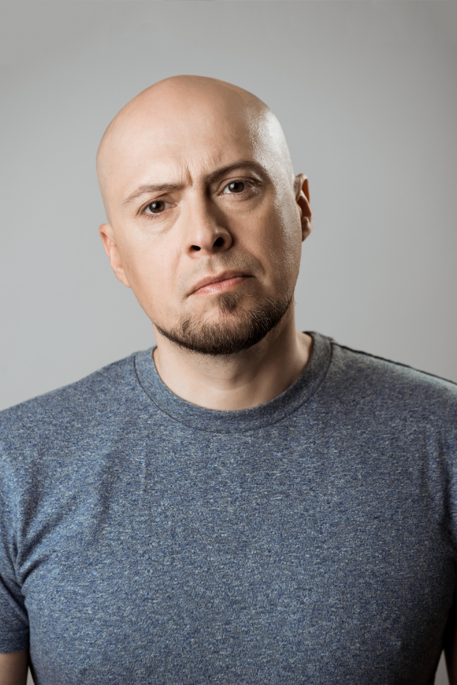 ¿Causas por las que se pierde Cabello? | Implantpel