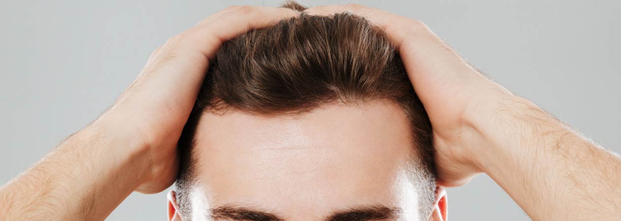 Los Resultados y la Evolución Tras un Injerto Capilar Masculino | Implantpel